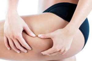 come_togliere_la_cellulite