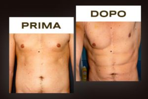 lejeune crema addominali