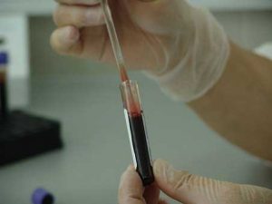 prep hiv